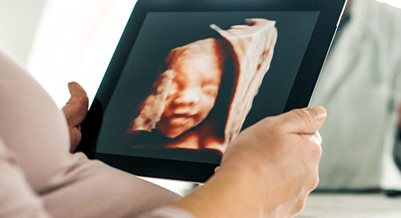 مراحل نمو الجنين بالصور