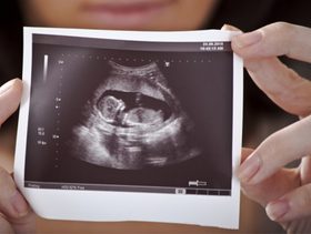 متى اسوي سونار في بدايه الحمل