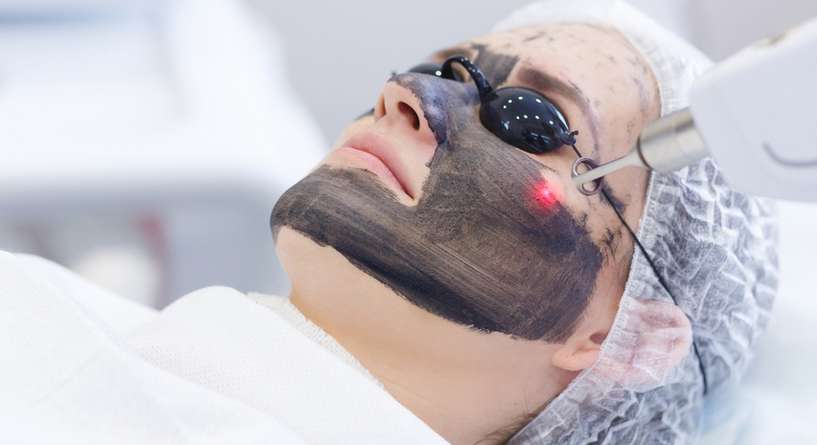 فوائد الليزر الكربوني للوجه والبشرة