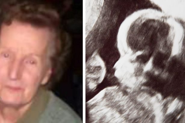 حامل ترى جدتها المتوفاة في صورة صوتية لجنينها