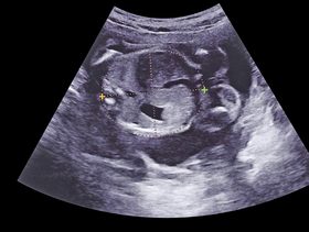 اين تكون حركة الجنين في الشهر الخامس