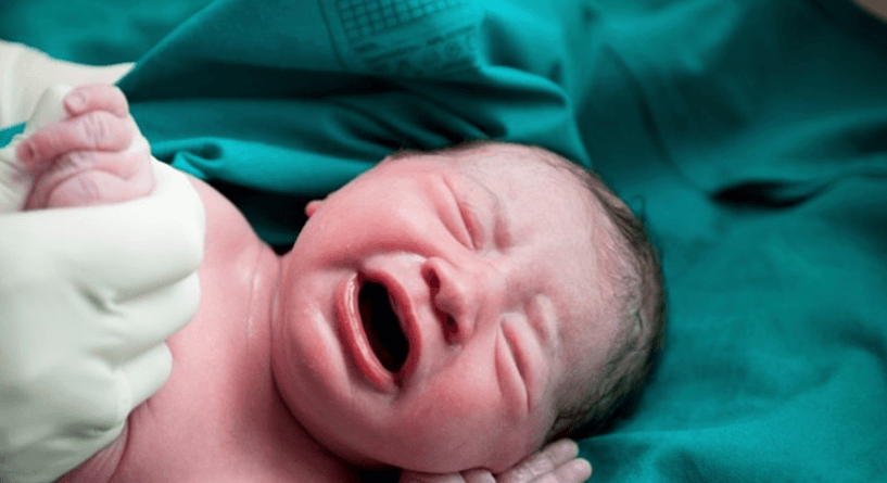 دراسة: الأطفال الذين يولدون عبر ولادة قيصرية أكثر عرضة للبدانة من غيرهم!
