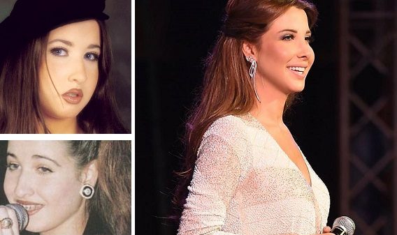 نانسي عجرم قبل تجميل الأسنان