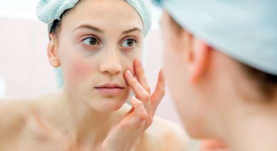 طرق طبيعية لعلاج التجاعيد والهالات السوداء تحت العين
