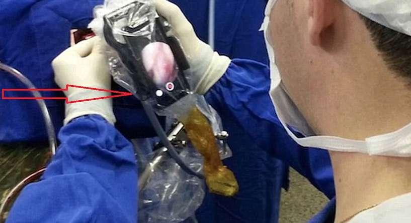 أطباء يستبدلون المعدات التقليدية بالأيفون في غرف العمليات