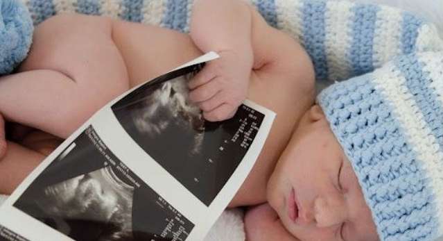 عندما يخطئ الـultrasound في تحديد جنس الجنين