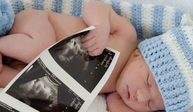 عندما يخطئ الـultrasound في تحديد جنس الجنين