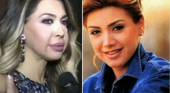 عمليات تجميل باءت بالفشل