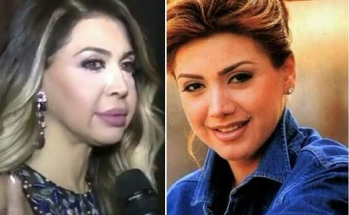 عمليات تجميل باءت بالفشل