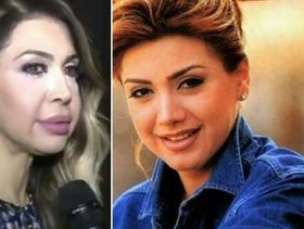 عمليات تجميل باءت بالفشل