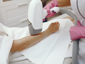 تعرفي الى أسباب ظهور الشعر بعد الليزر بكثافة وكيفية التخلص منه!