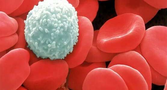 مرض سرطان الدم | أعراض سرطان الدم، اسباب سرطان الدم، علاج سرطان الدم