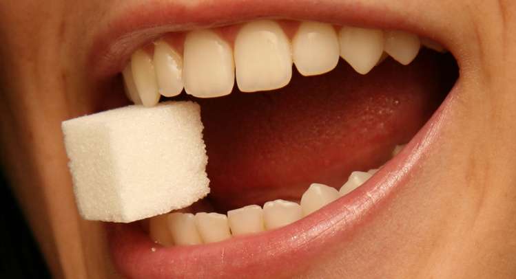 اسباب تسوس الاسنان | انواع السكريات المسؤولة عن تسوس الاسنان