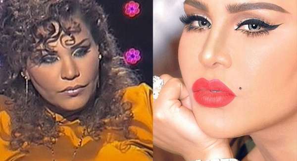 أحلام الشامسي قبل وبعد تكبير شفتيها
