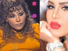 أحلام الشامسي قبل وبعد تكبير شفتيها