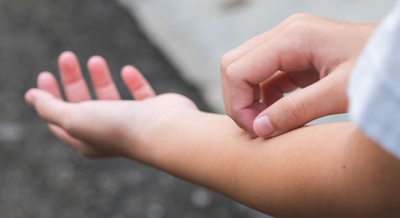 طرق علاج حساسية الجلد عند الاطفال من الاكل