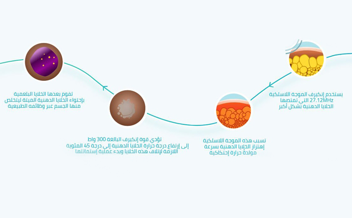 انفوغرافيك: طريقة عمل enCurve