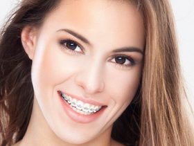 ما هي فرشاة التقويم