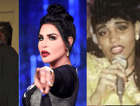صور احلام قبل وبعد عمليات التجميل