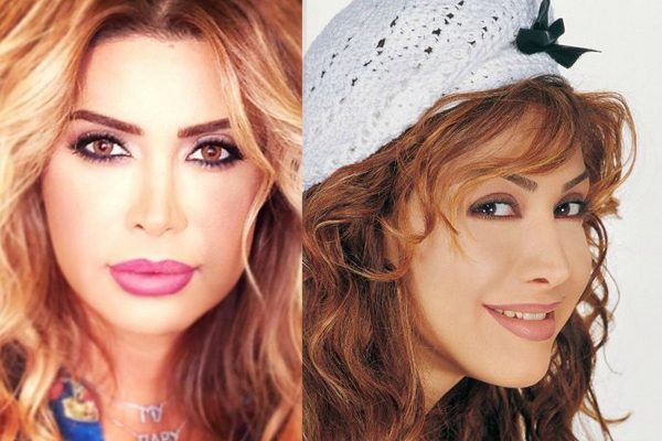 نوال الزغبي قبل وبعد تكبير شفتيها