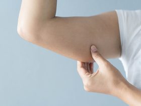 تعلمي كيفية علاج الترهلات بعد فقدان الوزن بطرق طبيعية!