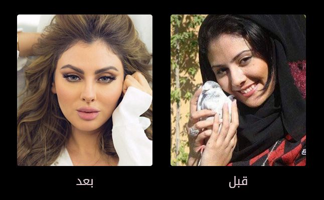 الفنانة مريم حسين وعمليات التجميل