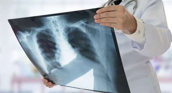 هل التهاب الرئه خطير