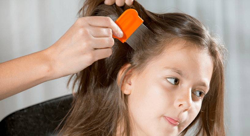 طرق علاج القمل للاطفال