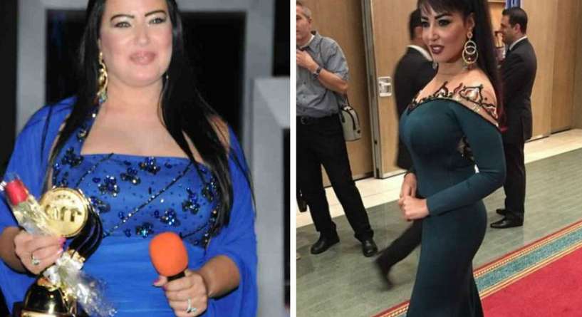 سمية الخشاب قبل وبعد خسارة الوزن