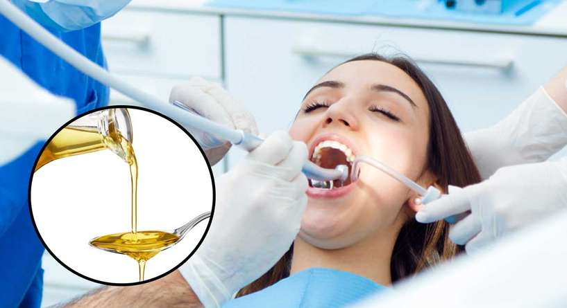 تقنية السحب بالزيت للوقاية من التسوس