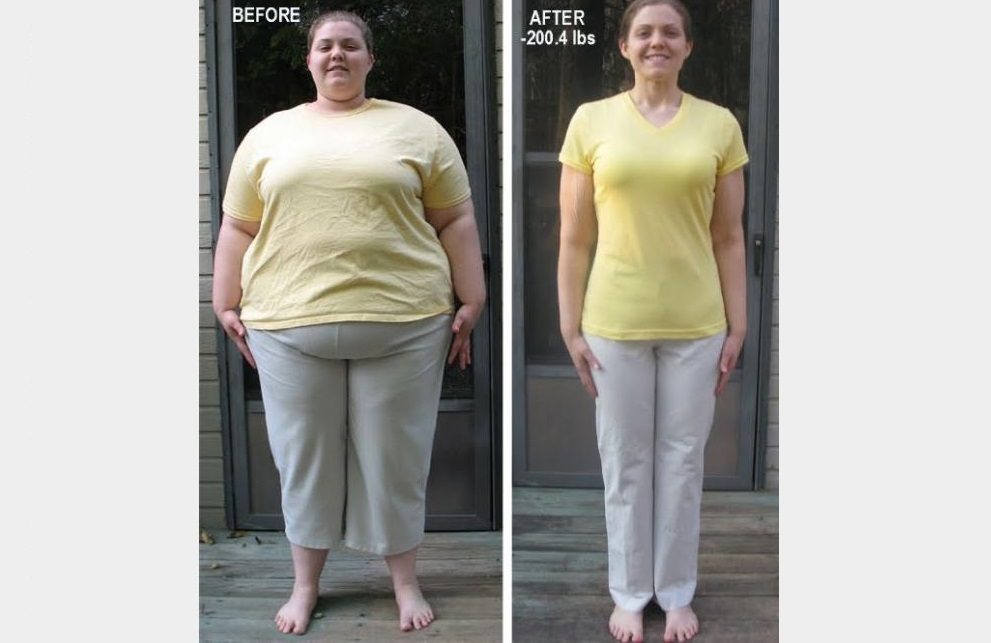 صور صادمة لنساء قبل وبعد خسارة الوزن