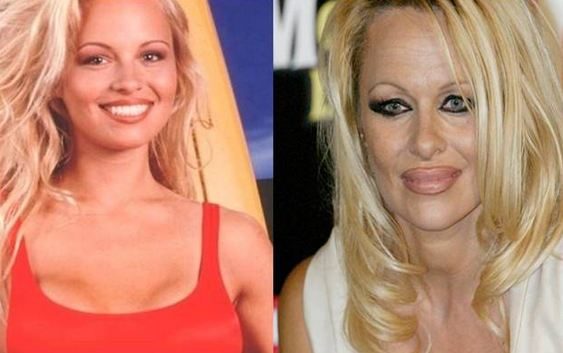 باميلا أندرسون Pamela Anderson