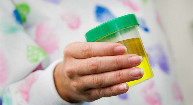 لماذا لون البول اصفر فاقع