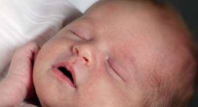 نصائح لمكافحة القلاع عند الام والطفل اثناء الرضاعة الطبيعية