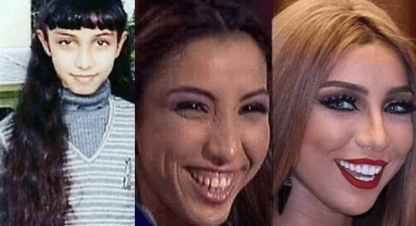 دنيا بطمة قبل الشهرة وبعدها