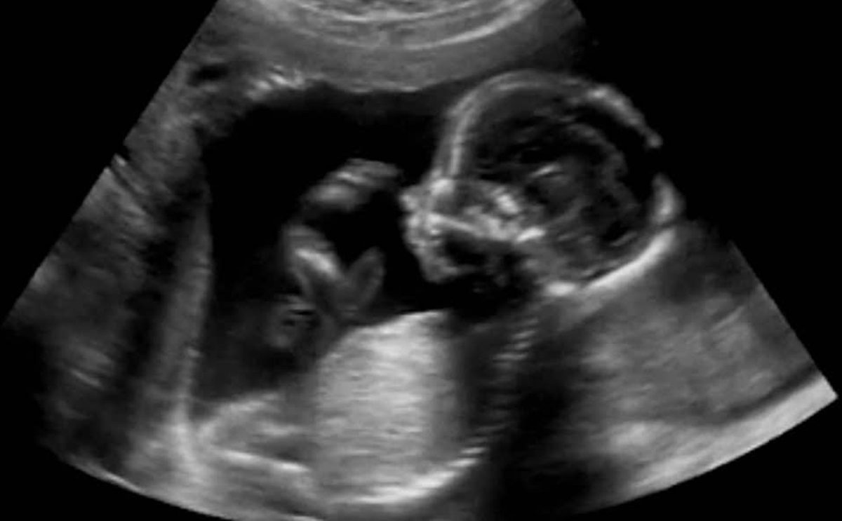 مراحل نمو الجنين بالصور شهريا
