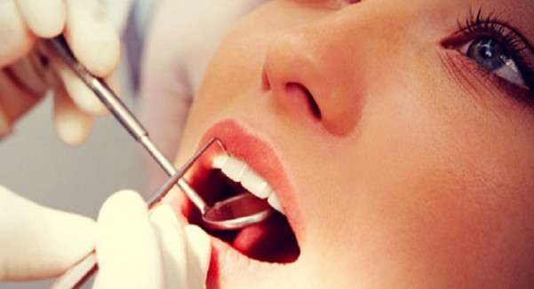 6 اضرار ناتجة عن ربط الاسنان للتنحيف