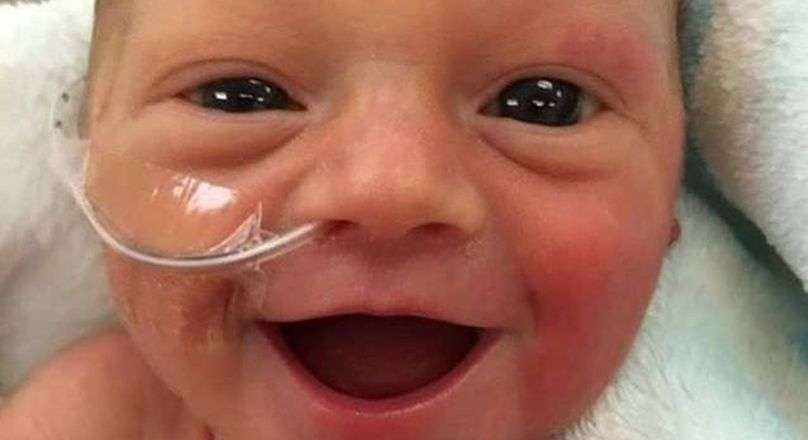 صورة رضيعة تضحك فرحًا بعد ولادتها قبل أوانها