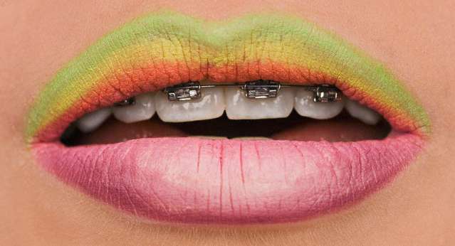 Mouth, Lip, Teeth
