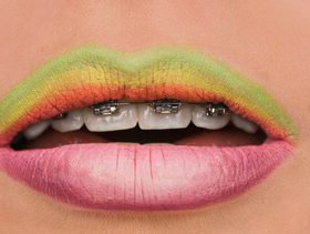 Mouth, Lip, Teeth