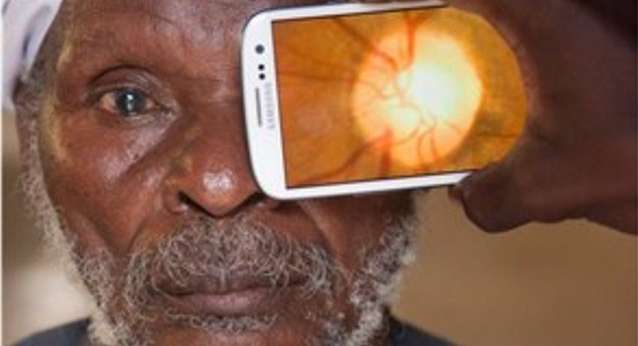 تطبيق على الهاتف الذكي يكشف امراض العين