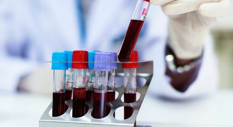 تحليل الدم الشامل ماذا يكشف ولماذا يطلبه الطبيب؟