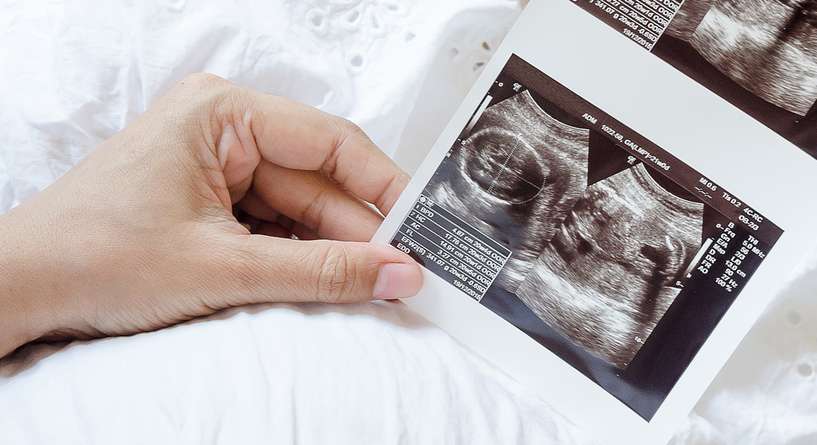 شكل الجنين في الشهر الرابع اذا كان ولد