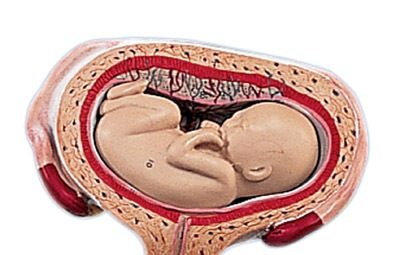 وضعيات الجنين عند الولادة