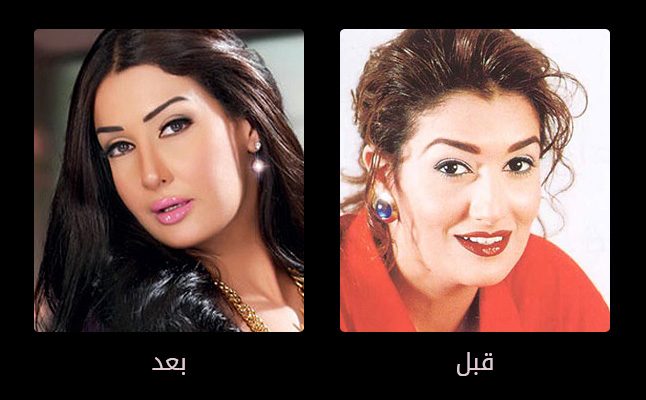 الفنانة غادة عبد الرزاق وعمليات التجميل