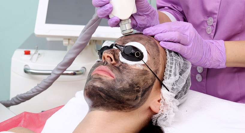 ليزر سكبترا إكس تي الكربوني لتقشير البشرة