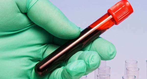 ما هي فوائد تحليل الدم للحمل؟