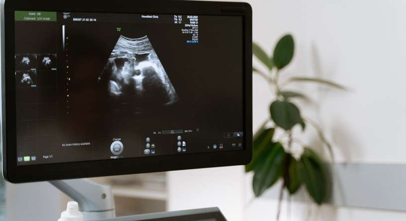 معلومات عن توقف نبض الجنين ورجع في الشهر الثالث