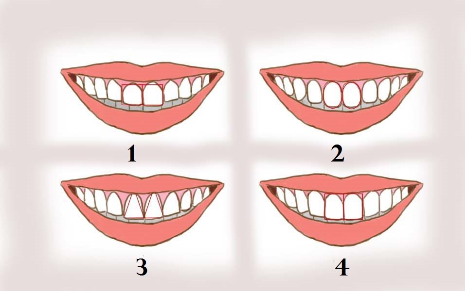 تحليل الشخصيتة من خلال شكل الأسنان