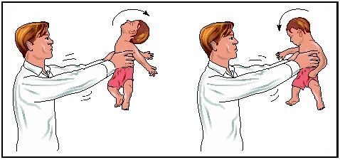 هز الرضيع يمكن أن يُحدث نزيفاً داخل الجمجمة